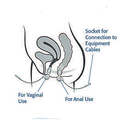 Image of Anuform insertions