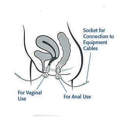Image of Anuform insertions