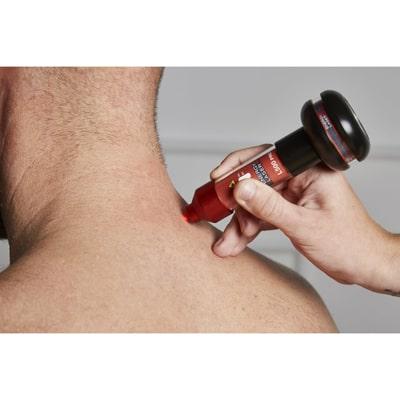 Image of L500 PRO treating a neck problem