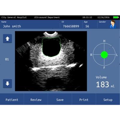AvantSonic Z5 screen bladder view in the Expert Mode