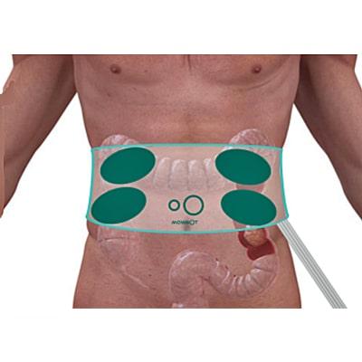 Image of Mowoot belt points over the abdomen