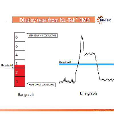 Image of EMG images
