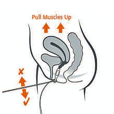 Image of Periform Plus with indicator wand inserted 