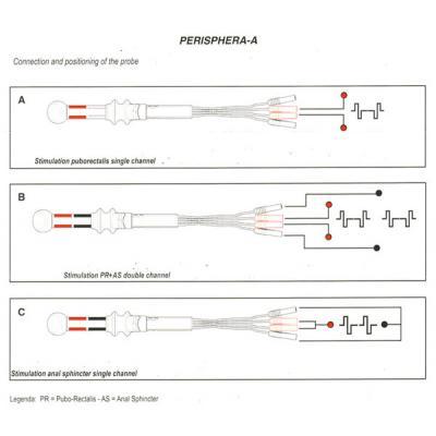 Image of positioning guide