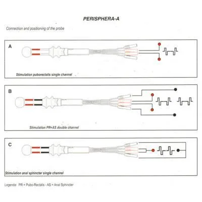 Image of positioning guide