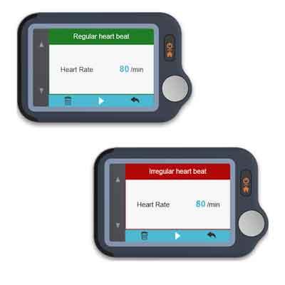 Image of Pulsebit-EX with and without signs of irregular heart beat