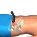 Wireless probe does not need aiming at the bladder, just placing on lower abdomen