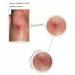 Image of healing of a wound with Youki